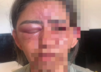 Mulher é estrangulada e espancada até desmaiar por amigo do filho em Goiás, diz polícia